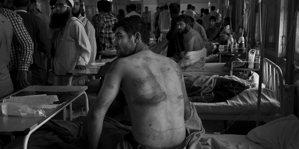 Kashmir youth Tortured 051022